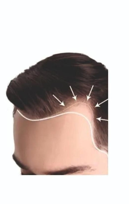 FGE Plus Hair Growth Spray 50 ml each Pack of 2